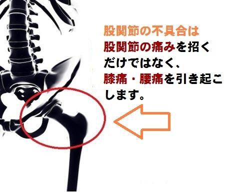 股関節の痛み | 歩き始めや立ち上がる時腰と股関節に痛み　