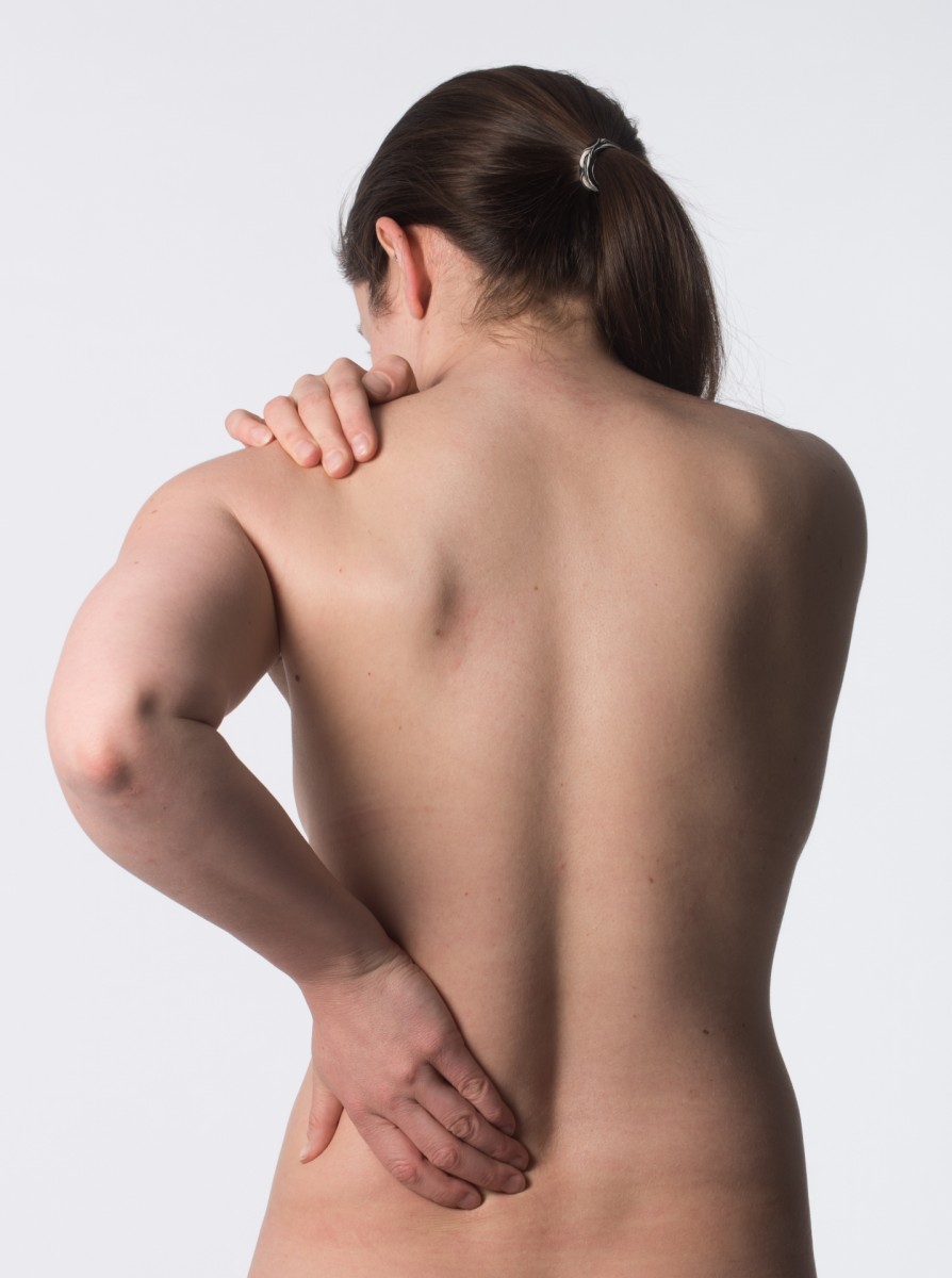 側弯症　背中や腰に痛みの出る札幌の60代女性